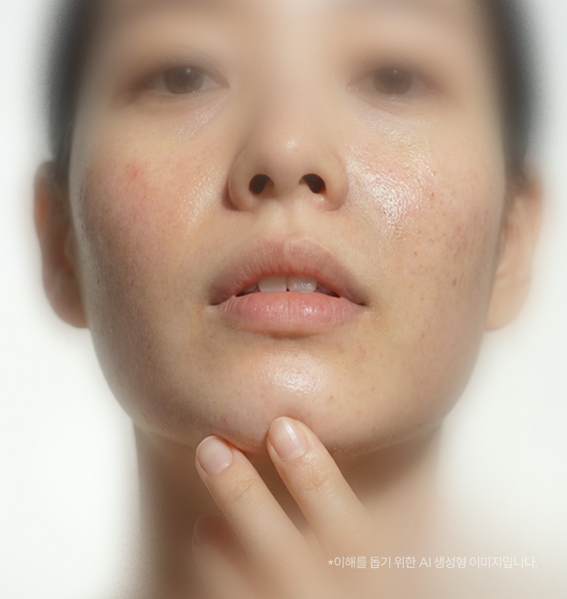 스킨부스터 치료