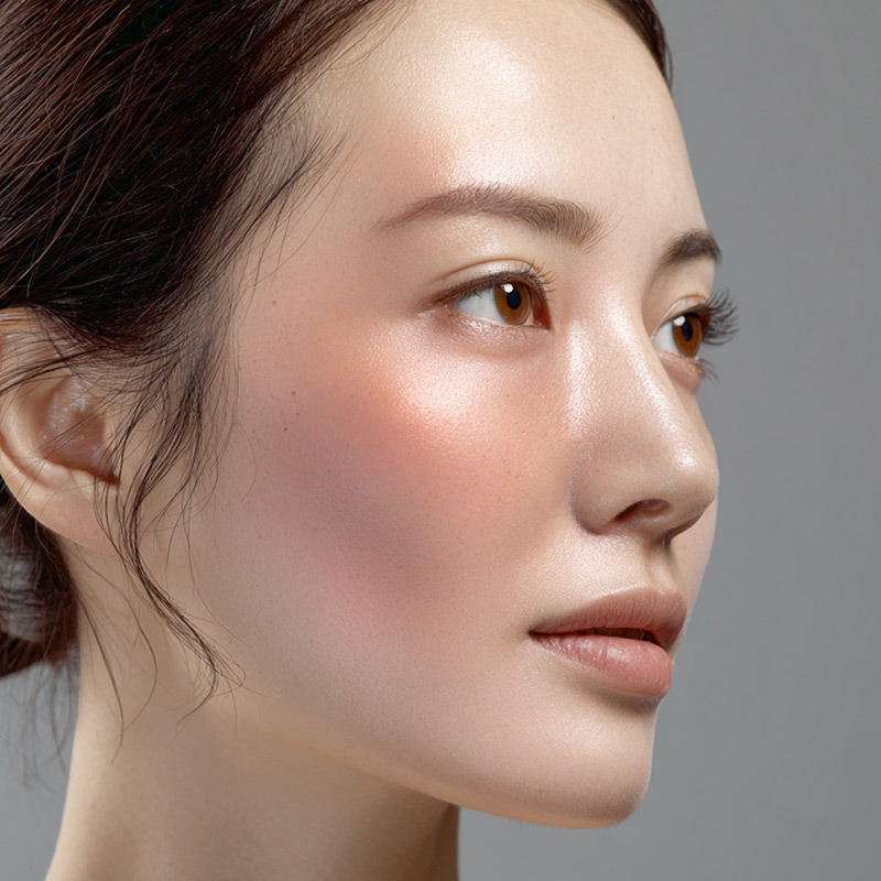 혈관 확장 색소 혼합 사례